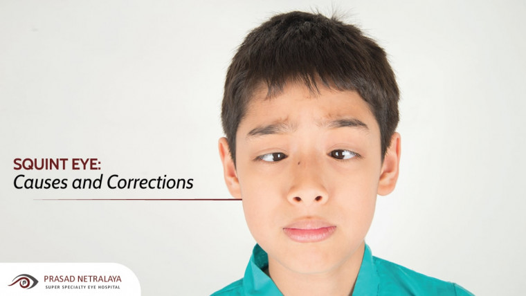 Squint Eye: Causes and Corrections
