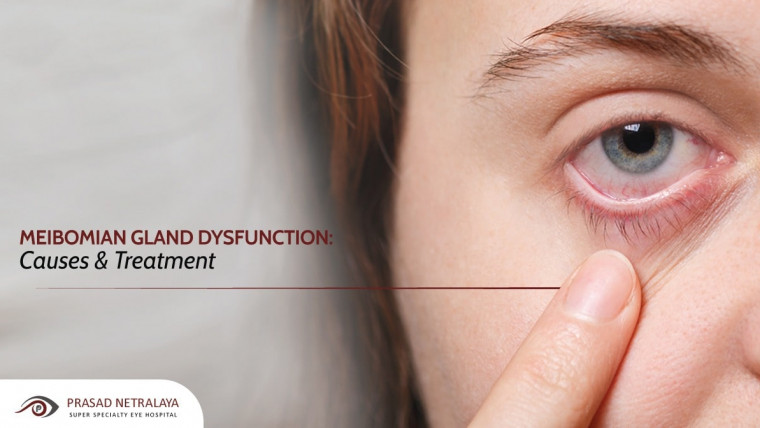 Meibomian Gland Dysfunction: Causes & Treatment