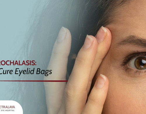Blepharochalasis: How to Cure Eyelid Bags
