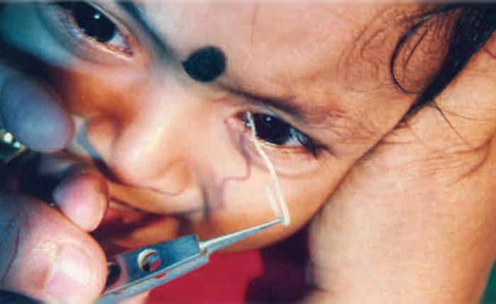 Paediatric Ophthalmology