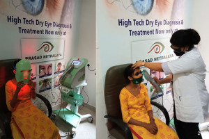 Dry eye therapy