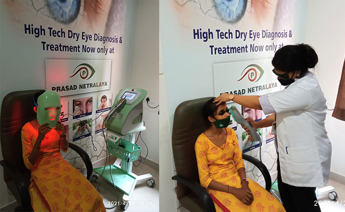 Dry eye therapy