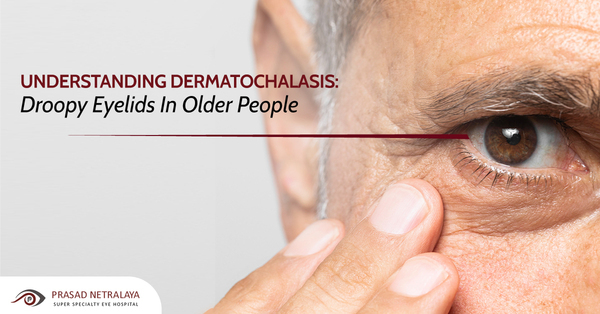Understanding Dermatochalasis: Droopy Eyelids In Older People
