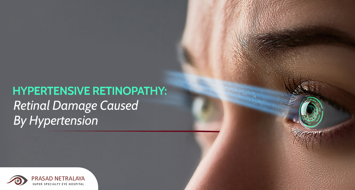 Hypertensive Retinopathy: Retinal Damage Caused by Hypertension