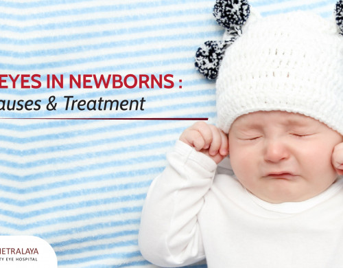 Sticky Eyes in Newborns : Signs, Causes & Treatment