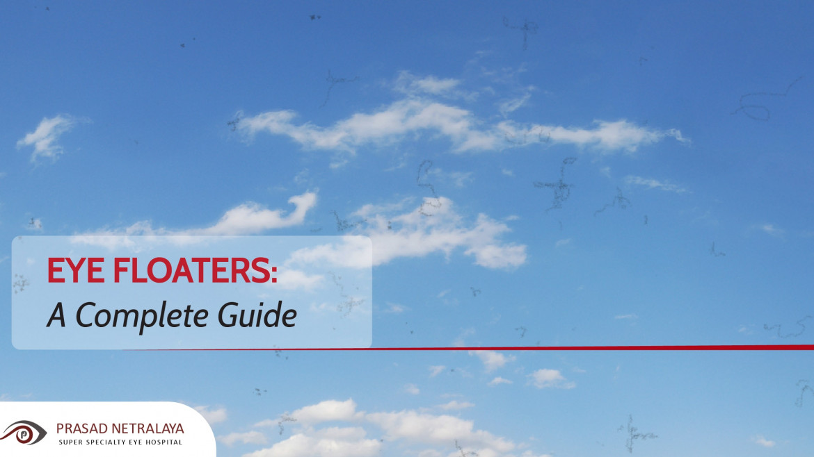 Eye Floaters: A Complete Guide