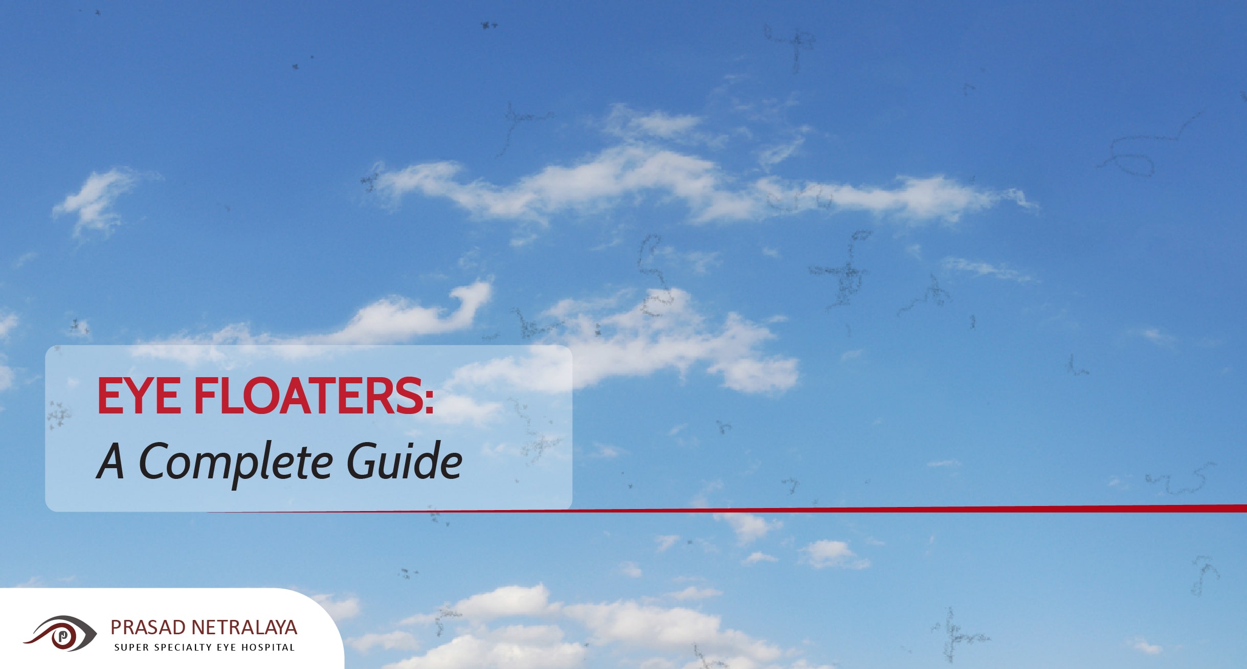 Eye Floaters: A Complete Guide