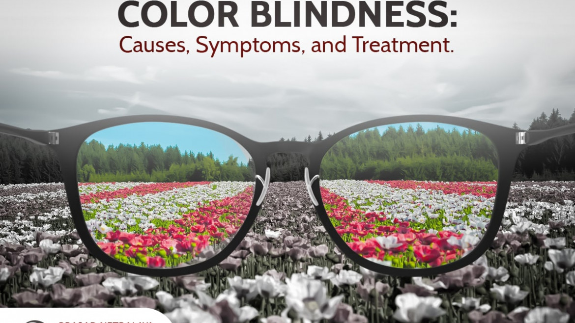 Color Blindness: Causes, Symptoms, and Treatment