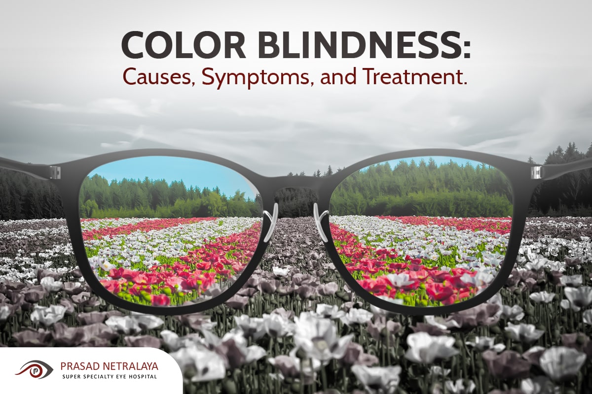 Color Blindness: Causes, Symptoms, and Treatment