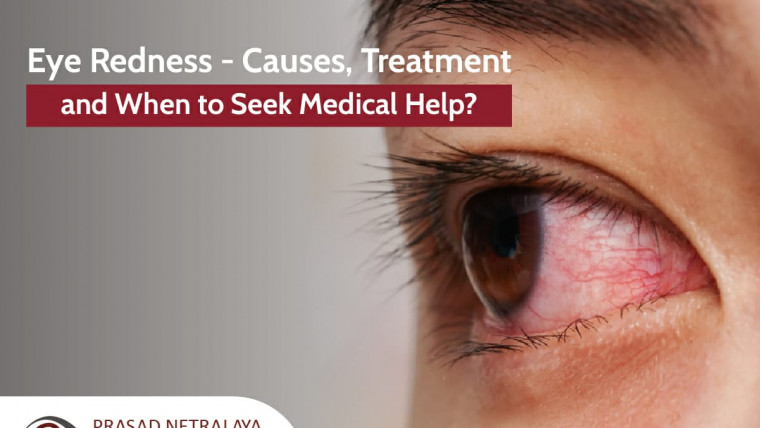 Eye Redness – Causes, Treatment and When to Seek Medical Help?