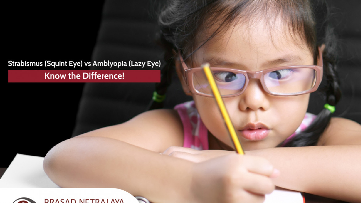 Strabismus (Squint Eye) vs Amblyopia (Lazy Eye): Know the Difference!