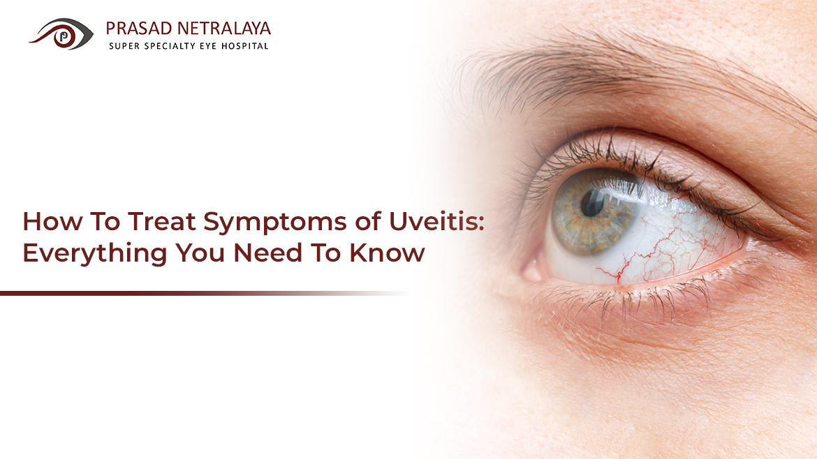 How To Treat Symptoms of Uveitis: Everything You Need To Know