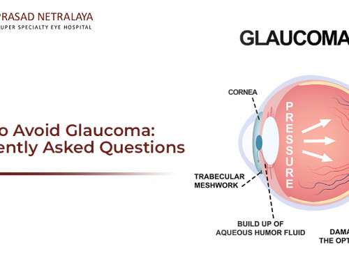 How To Avoid Glaucoma: Frequently Asked Questions