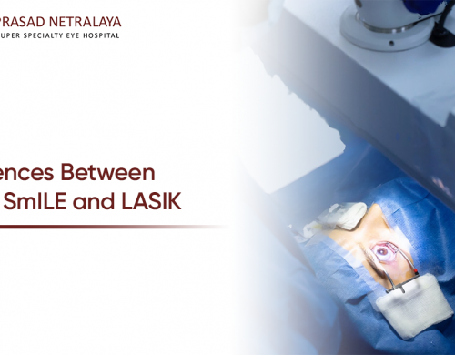 ReLEx SMILE vs LASIK: Which is Better for You?