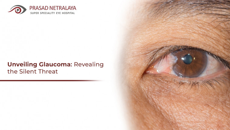 Unveiling Glaucoma: Revealing the Silent Threat