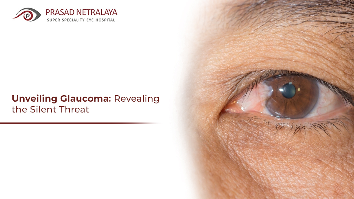 Unveiling Glaucoma: Revealing the Silent Threat
