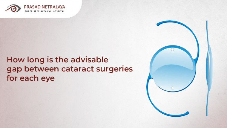 How long is the advisable gap between cataract surgeries for each eye