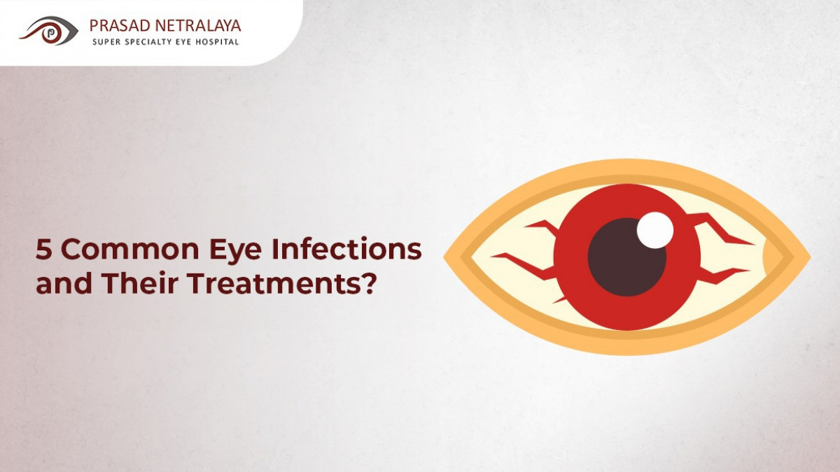 5 Common Eye Infections and Their Treatments - Prasad Netralaya