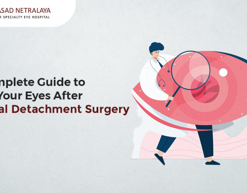 A Complete Guide to Care Your Eyes After Retinal Detachment Surgery