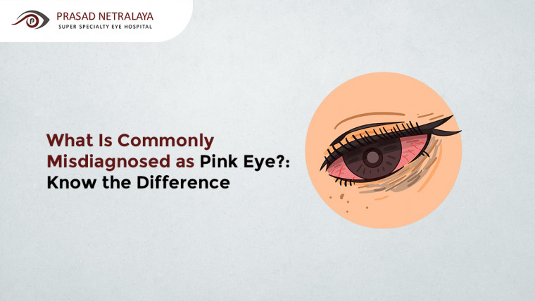 What Is Commonly Misdiagnosed as Pink Eye?: Know the Difference