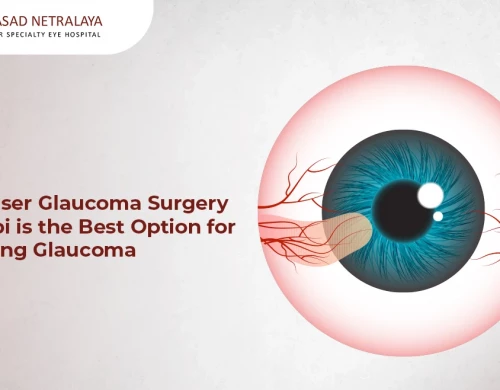 Why Laser Glaucoma Surgery in Udupi is the Best Option for Managing Glaucoma?