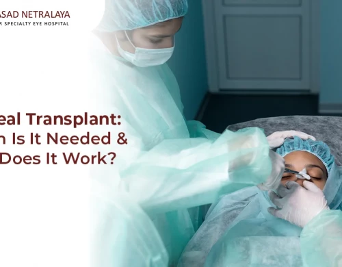 Corneal Transplant: When is it Needed & How Does it Work?
