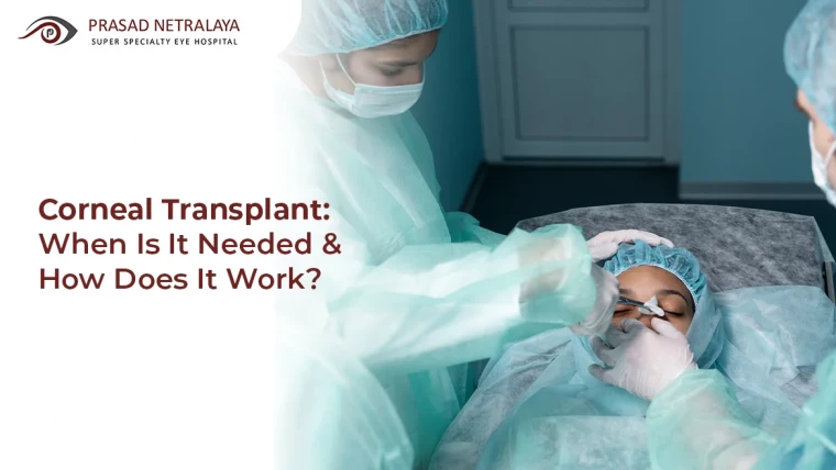 Corneal Transplant: When is it Needed & How Does it Work?
